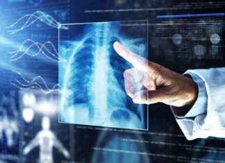 AI-Based Lung Cancer Imaging Trial: Invenio’s Enrollment Completion news-10082024-204531